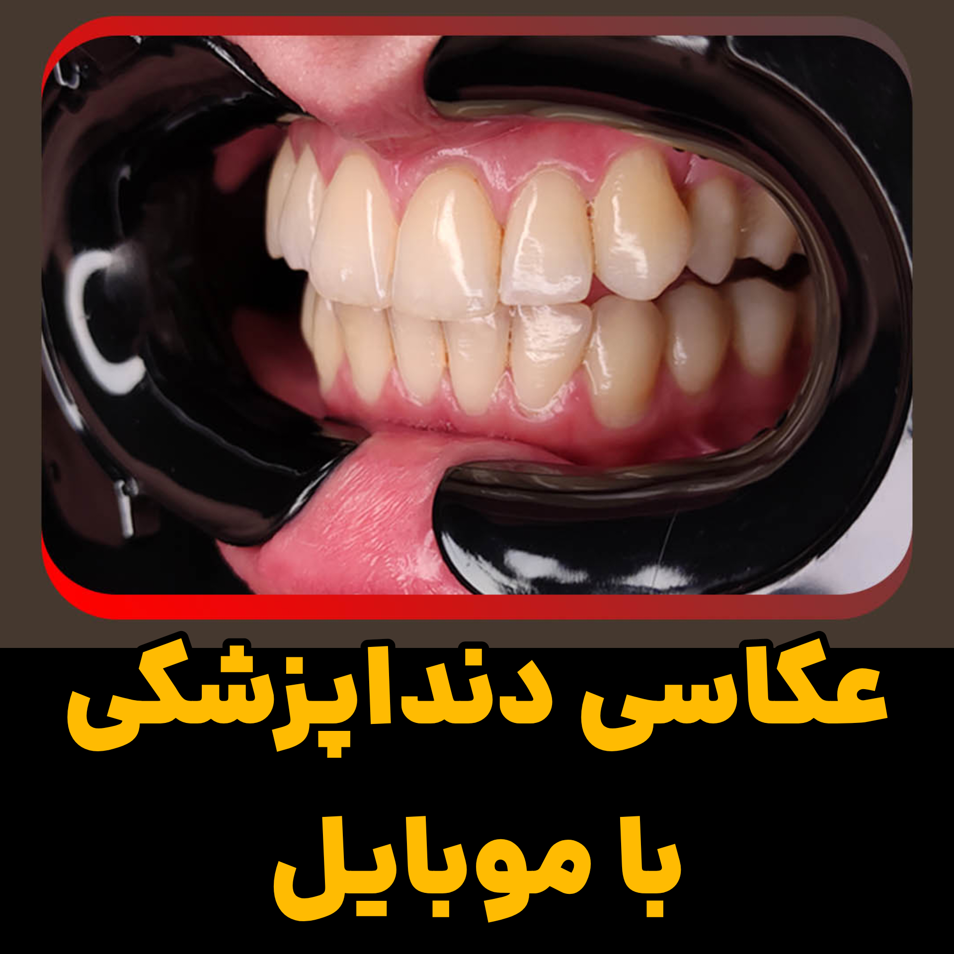 آموزش موبایلگرافی دندانپزشکی