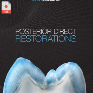 posterior direct Restorations